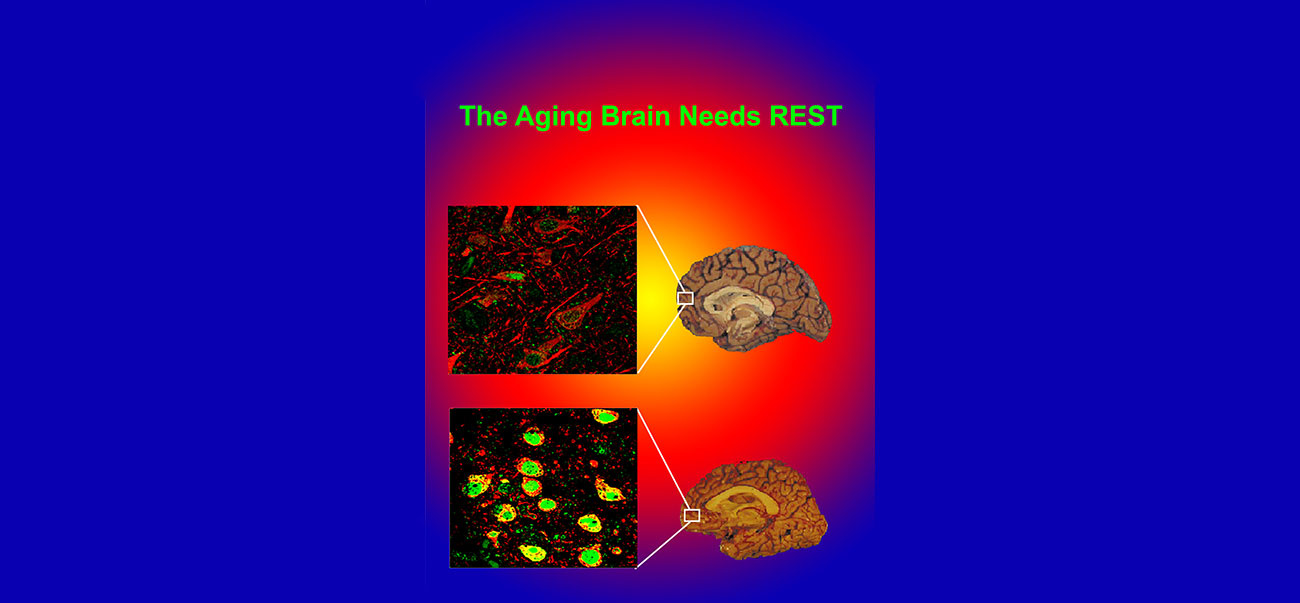The Aging Brain Needs REST